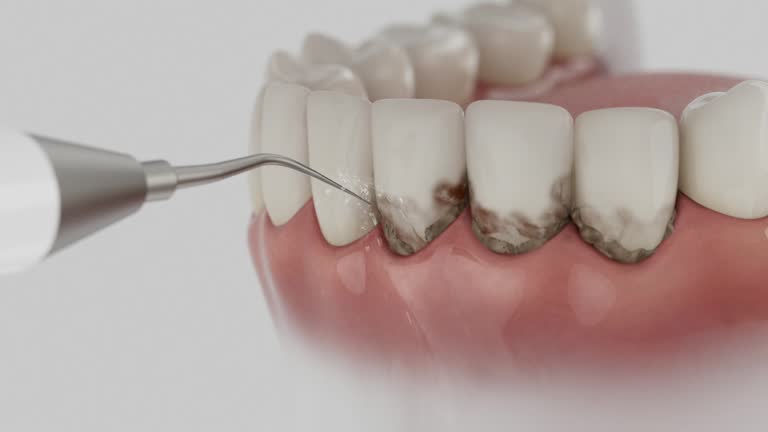 Trusted Dental Implants service in Parkwood, CA - Dentist Open Now